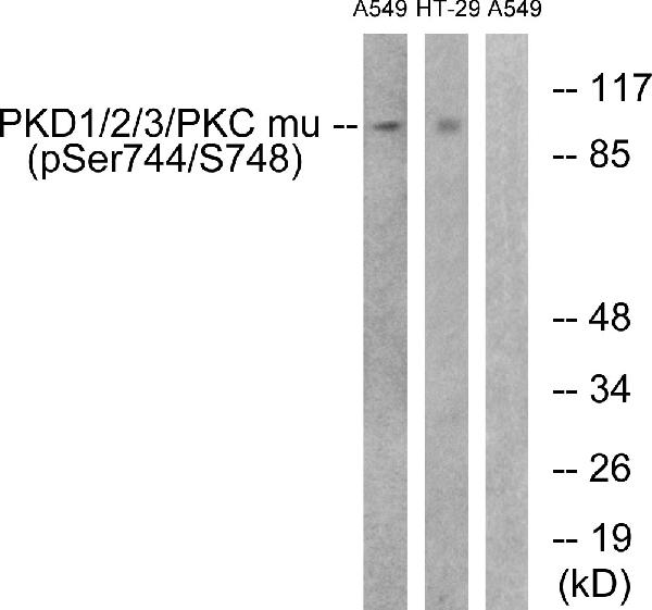 Anti Phospho Pkd1 2 3 Pkc Mu Ser738 Ser742 Antibody P