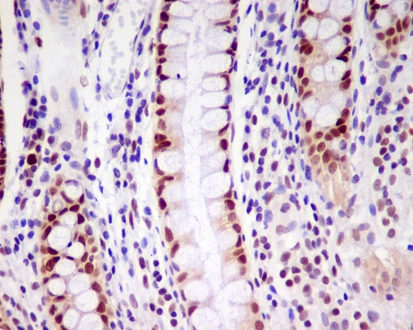 Immunohistochemical analysis of paraffin-embedded human colon, using PCNA Antibody.