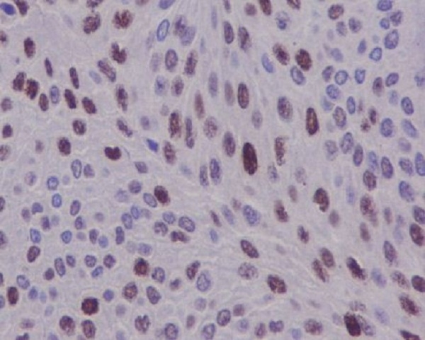 Immunohistochemical analysis of paraffin-embedded human bladder, using Cyclin D1 Antibody.