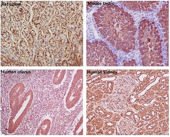 Immunohistochemical analysis of paraffin-embedded (1) Rat colon; (2) Mouse testis; (3) Human uterus; (4) Human kidney, using GAPDH Antibody.