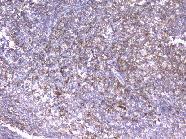 IHC analysis of CD18 using anti-CD18 antibody (M00458-1). CD18 was detected in paraffin-embedded section of human tonsil tissue. Heat mediated antigen retrieval was performed in citrate buffer (pH6, epitope retrieval solution) for 20 mins. The tissue section was blocked with 10% goat serum. The tissue section was then incubated with 2μg/ml rabbit anti-CD18 Antibody (M00458-1) overnight at 4°C. Biotinylated goat anti-mouse IgG was used as secondary antibody and incubated for 30 minutes at 37°C. The tissue section was developed using Strepavidin-Biotin-Complex (SABC)(Catalog # SA1021) with DAB as the chromogen.