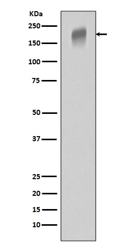 Western blot analysis of VEGFR1 expression in A431 cell lysate.