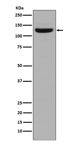 Western blot analysis of Collagen I in Human stomach tissue lysate.