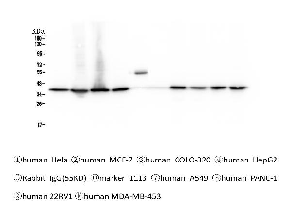 Western blot analysis of APE1 using anti-APE1 antibody (M00627). Electrophoresis was performed on a 5-20% SDS-PAGE gel at 70V (Stacking gel) / 90V (Resolving gel) for 2-3 hours. The sample well of each lane was loaded with 50ug of sample under reducing conditions. Lane 1: human Hela whole cell lysates, Lane 2: human MCF-7 whole cell lysates, Lane 3: human COLO-320 whole cell lysates, Lane 4: human HepG2 whole cell lysates, Lane 5: Rabbit IgG, Lane 6: Marker 1113, Lane 7: human A549 whole cell lysates, Lane 8: human PANC-1 whole cell lysates, Lane 9: human 22RV1 whole cell lysates, Lane 10: human MDA-MB-453 whole cell lysates. After Electrophoresis, proteins were transferred to a Nitrocellulose membrane at 150mA for 50-90 minutes. Blocked the membrane with 5% Non-fat Milk/ TBS for 1.5 hour at RT. The membrane was incubated with mouse anti-APE1 antigen affinity purified monoclonal antibody (Catalog # M00627) at 0.5 μg/mL overnight at 4°C, then washed with TBS-0.1%Tween 3 times with 5 minutes each and probed with a goat anti-mouse IgG-HRP secondary antibody at a dilution of 1:10000 for 1.5 hour at RT. The signal is developed using an Enhanced Chemiluminescent detection (ECL) kit (Catalog # EK1001) with Tanon 5200 system.