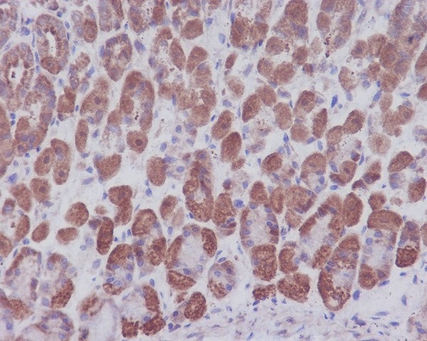 Immunohistochemical analysis of paraffin-embedded mouse stomach, using IKB alpha Antibody(M01139) NFKBIA was detected in paraffin-embedded tissue section. Heat mediated antigen retrieval was performed in citrate buffer (pH6, epitope retrieval solution) for 20 mins. The tissue section was blocked with 10% goat serum. The tissue section was then incubated with 1ug/ml rabbit anti-NFKBIA Antibody (M01139)overnight at 4°C. Biotinylated goat anti-rabbit IgG was used as secondary antibody and incubated for 30 minutes at 37°C. The tissue section was developed using Strepavidin-Biotin-Complex (SABC)(Catalog # SA1022) with DAB as the chromogen.