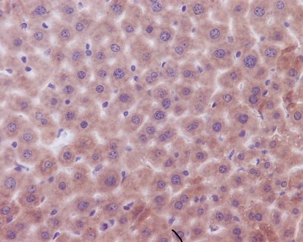 Immunohistochemical analysis of paraffin-embedded mouse liver, using Bak Antibody(M01163) BAK1 was detected in paraffin-embedded tissue section. Heat mediated antigen retrieval was performed in citrate buffer (pH6, epitope retrieval solution) for 20 mins. The tissue section was blocked with 10% goat serum. The tissue section was then incubated with 1ug/ml rabbit anti-BAK1 Antibody (M01163)overnight at 4 Biotinylated goat anti-rabbit IgG was used as secondary antibody and incubated for 30 minutes at 37 The tissue section was developed using Strepavidin-Biotin-Complex (SABC)(Catalog # SA1022) with DAB as the chromogen.