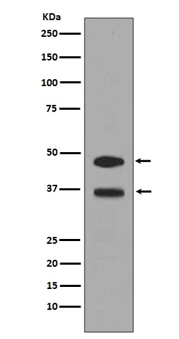 Western blot analysis of FosB expression in C6 cell lysate treated with serum (M01569). Electrophoresis was performed on a 5-20% SDS-PAGE gel at 70V (Stacking gel) / 90V (Resolving gel) for 2-3 hours. The sample well of each lane was loaded with 50ug of sample under reducing conditions. After Electrophoresis, proteins were transferred to a Nitrocellulose membrane at 150mA for 50-90 minutes. Blocked the membrane with 5% Non-fat Milk/ TBS for 1.5 hour at RT. The membrane was incubated with rabbit anti-FOSB monoclonal antibody (Catalog # M01569) overnight at 4°C, then washed with TBS-0.1%Tween 3 times with 5 minutes each and probed with a goat anti-rabbit IgG-HRP secondary antibody at a dilution of 1:10000 for 1.5 hour at RT. The signal is developed using an Enhanced Chemiluminescent detection (ECL) kit (Catalog # EK1002) with Tanon 5200 system.