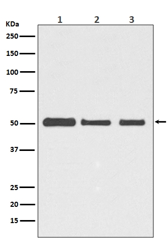 Western blot analysis of beta III Tubulin expression in HeLa cell lysate (M01857). Electrophoresis was performed on a 5-20% SDS-PAGE gel at 70V (Stacking gel) / 90V (Resolving gel) for 2-3 hours. The sample well of each lane was loaded with 50ug of sample under reducing conditions. After Electrophoresis, proteins were transferred to a Nitrocellulose membrane at 150mA for 50-90 minutes. Blocked the membrane with 5% Non-fat Milk/ TBS for 1.5 hour at RT. The membrane was incubated with rabbit anti-TUBB3 monoclonal antibody (Catalog # M01857) overnight at 4 then washed with TBS-0.1%Tween 3 times with 5 minutes each and probed with a goat anti-rabbit IgG-HRP secondary antibody at a dilution of 1:10000 for 1.5 hour at RT. The signal is developed using an Enhanced Chemiluminescent detection (ECL) kit (Catalog # EK1002) with Tanon 5200 system. A specific band was detected for TUBB3