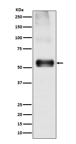 Western blot analysis of EAAT1 expression in Mouse brain lysate.