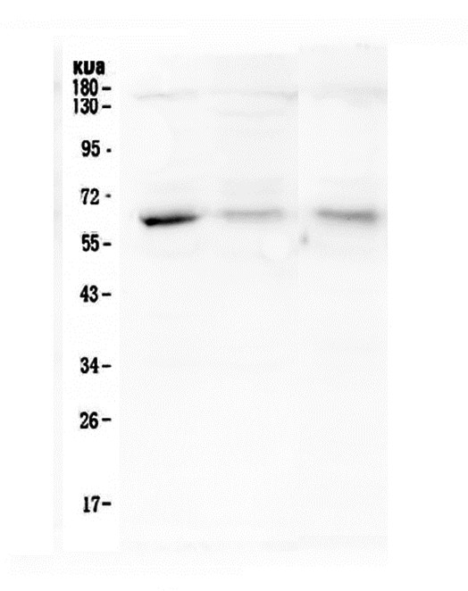 Western blot analysis of ARSA using anti-ARSA antibody (M02583). Electrophoresis was performed on a 10% SDS-PAGE gel at 70V (Stacking gel) / 90V (Resolving gel) for 2-3 hours. The sample well of each lane was loaded with 50ug of sample under reducing conditions. Lane 1: human A375 whole cell lysate, Lane 2: human A549 whole cell lysate, Lane 3: human SMMC-7721 whole cell lysate. After Electrophoresis, proteins were transferred to a Nitrocellulose membrane at 150mA for 50-90 minutes. Blocked the membrane with 5% Non-fat Milk/ TBS for 1.5 hour at RT. The membrane was incubated with mouse anti-ARSA antigen affinity purified monoclonal antibody (Catalog # M02583) at 0.5 μg/mL overnight at 4°C, then washed with TBS-0.1%Tween 3 times with 5 minutes each and probed with a goat anti-mouse IgG-HRP secondary antibody at a dilution of 1:10000 for 1.5 hour at RT. The signal is developed using an Enhanced Chemiluminescent detection (ECL) kit (Catalog # EK1001) with Tanon 5200 system.