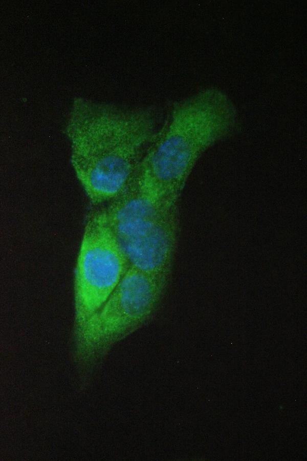 IF analysis of APP using anti-APP antibody (PB9091). APP was detected in immunocytochemical section of A431 cell. Enzyme antigen retrieval was performed using IHC enzyme antigen retrieval reagent (AR0022) for 15 mins. The cells were blocked with 10% goat serum. And then incubated with 2μg/mL rabbit anti-APP Antibody (PB9091) overnight at 4°C. DyLight®488 Conjugated Goat Anti-Rabbit IgG (BA1127) was used as secondary antibody at 1:100 dilution and incubated for 30 minutes at 37°C. The section was counterstained with DAPI. Visualize using a fluorescence microscope and filter sets appropriate for the label used.