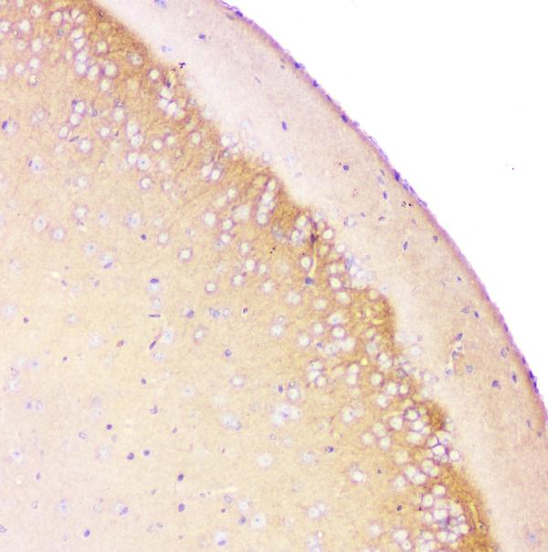 IHC analysis of APP using anti-APP antibody (PB9091). APP was detected in paraffin-embedded section of mouse brain tissue. Heat mediated antigen retrieval was performed in citrate buffer (pH6, epitope retrieval solution) for 20 mins. The tissue section was blocked with 10% goat serum. The tissue section was then incubated with 1μg/ml rabbit anti-APP Antibody (PB9091) overnight at 4°C. Biotinylated goat anti-rabbit IgG was used as secondary antibody and incubated for 30 minutes at 37°C. The tissue section was developed using Strepavidin-Biotin-Complex (SABC)(Catalog # SA1022) with DAB as the chromogen.