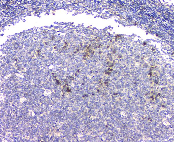 IHC analysis of APP using anti-APP antibody (PB9091). APP was detected in paraffin-embedded section of human tonsil tissue. Heat mediated antigen retrieval was performed in citrate buffer (pH6, epitope retrieval solution) for 20 mins. The tissue section was blocked with 10% goat serum. The tissue section was then incubated with 1μg/ml rabbit anti-APP Antibody (PB9091) overnight at 4°C. Biotinylated goat anti-rabbit IgG was used as secondary antibody and incubated for 30 minutes at 37°C. The tissue section was developed using Strepavidin-Biotin-Complex (SABC)(Catalog # SA1022) with DAB as the chromogen.