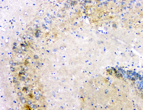 IHC analysis of APP using anti-APP antibody (PB9091). APP was detected in paraffin-embedded section of rat brain tissue. Heat mediated antigen retrieval was performed in citrate buffer (pH6, epitope retrieval solution) for 20 mins. The tissue section was blocked with 10% goat serum. The tissue section was then incubated with 1μg/ml rabbit anti-APP Antibody (PB9091) overnight at 4°C. Biotinylated goat anti-rabbit IgG was used as secondary antibody and incubated for 30 minutes at 37°C. The tissue section was developed using Strepavidin-Biotin-Complex (SABC)(Catalog # SA1022) with DAB as the chromogen.