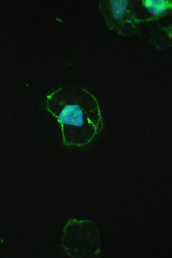 IF analysis of CTNNB1 using anti-CTNNB1 antibody (A00004) CTNNB1 was detected in immunocytochemical section of A431 cell. Enzyme antigen retrieval was performed using IHC enzyme antigen retrieval reagent (AR0022) for 15 mins. The cells were blocked with 10% goat serum. And then incubated with 2μg/mL rabbit anti-CTNNB1 Antibody (A00004) overnight at 4°C. DyLight®488 Conjugated Goat Anti-Rabbit IgG (BA1127) was used as secondary antibody at 1:100 dilution and incubated for 30 minutes at 37°C. The section was counterstained with DAPI. Visualize using a fluorescence microscope and filter sets appropriate for the label used.