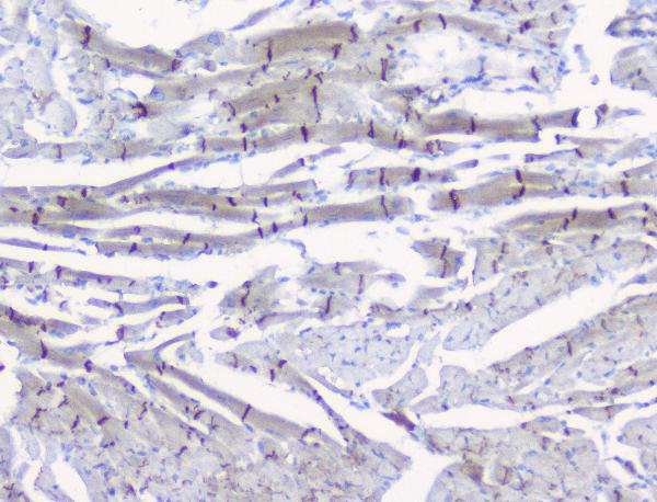 IHC analysis of CTNNB1 using anti-CTNNB1 antibody (A00004). CTNNB1 was detected in paraffin-embedded section of rat heart tissue. Heat mediated antigen retrieval was performed in citrate buffer (pH6, epitope retrieval solution) for 20 mins. The tissue section was blocked with 10% goat serum. The tissue section was then incubated with 1μg/ml rabbit anti-CTNNB1 Antibody (A00004) overnight at 4°C. Biotinylated goat anti-rabbit IgG was used as secondary antibody and incubated for 30 minutes at 37°C. The tissue section was developed using Strepavidin-Biotin-Complex (SABC)(Catalog # SA1022) with DAB as the chromogen.