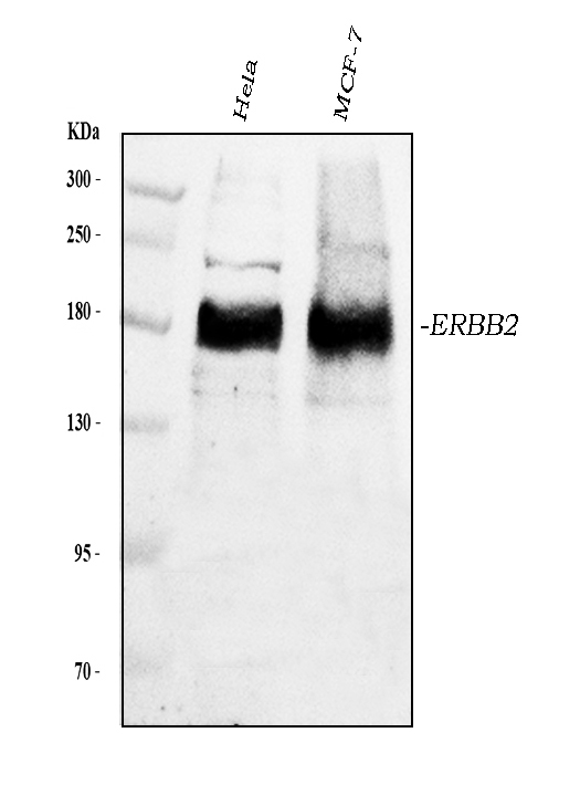 Western blot analysis of ErbB 2 using anti-ErbB 2 antibody (A00010-2).