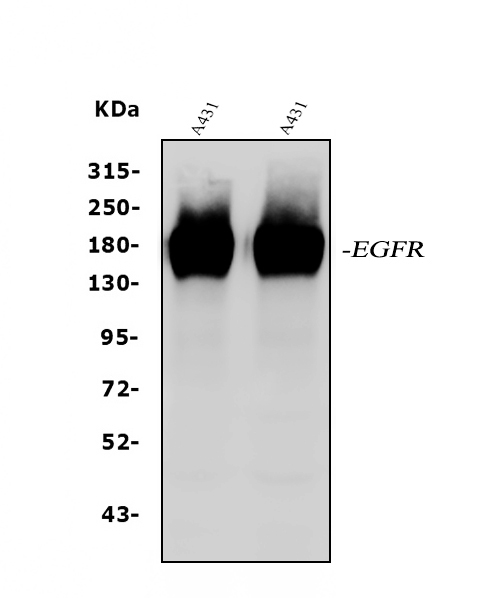 Western blot analysis of EGFR using anti-EGFR antibody (A00023).