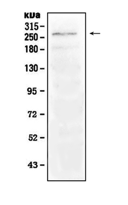 Western blot analysis of Notch1 using anti-Notch1 antibody (A00033-2). Electrophoresis was performed on a 5-20% SDS-PAGE gel at 70V (Stacking gel) / 90V (Resolving gel) for 2-3 hours. The sample well of each lane was loaded with 50ug of sample under reducing conditions. Lane 1: mouse skeletal muscle tissue lysate. After Electrophoresis, proteins were transferred to a Nitrocellulose membrane at 150mA for 50-90 minutes. Blocked the membrane with 5% Non-fat Milk/ TBS for 1.5 hour at RT. The membrane was incubated with rabbit anti-Notch1 antigen affinity purified polyclonal antibody (Catalog # A00033-2) at 0.5 μg/mL overnight at 4°C, then washed with TBS-0.1%Tween 3 times with 5 minutes each and probed with a goat anti-rabbit IgG-HRP secondary antibody at a dilution of 1:10000 for 1.5 hour at RT. The signal is developed using an Enhanced Chemiluminescent detection (ECL) kit (Catalog # EK1002) with Tanon 5200 system. A specific band was detected for Notch1 at approximately 272KD. The expected band size for Notch1 is at 272KD.