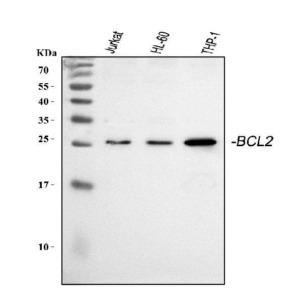 Western blot analysis of BCL2 using anti-BCL2 antibody (A00040-2).