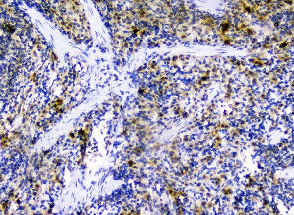 IHC analysis of CXCL12 using anti-CXCL12 antibody (A00053-2). CXCL12 was detected in paraffin-embedded section of rat spleen tissues. Heat mediated antigen retrieval was performed in citrate buffer (pH6, epitope retrieval solution) for 20 mins. The tissue section was blocked with 10% goat serum. The tissue section was then incubated with 1μg/ml rabbit anti-CXCL12 Antibody (A00053-2) overnight at 4°C. Biotinylated goat anti-rabbit IgG was used as secondary antibody and incubated for 30 minutes at 37°C. The tissue section was developed using Strepavidin-Biotin-Complex (SABC)(Catalog # SA1022) with DAB as the chromogen.