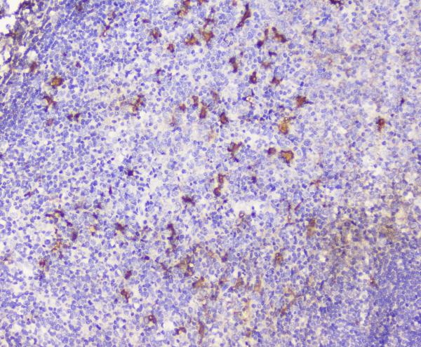 IHC analysis of CXCL12 using anti-CXCL12 antibody (A00053-2).