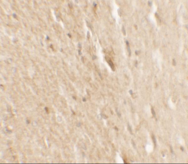 Anti-B-raf Antibody A00075