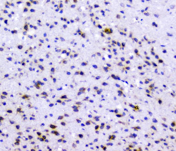 IHC analysis of Rad51 using anti-Rad51 antibody (A00088). Rad51 was detected in paraffin-embedded section of rat brain tissues. Heat mediated antigen retrieval was performed in citrate buffer (pH6, epitope retrieval solution) for 20 mins. The tissue section was blocked with 10% goat serum. The tissue section was then incubated with 1μg/ml rabbit anti-Rad51 Antibody (A00088) overnight at 4°C. Biotinylated goat anti-rabbit IgG was used as secondary antibody and incubated for 30 minutes at 37°C. The tissue section was developed using Strepavidin-Biotin-Complex (SABC)(Catalog # SA1022) with DAB as the chromogen.