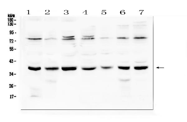 Western blot analysis of Rad51 using anti-Rad51 antibody (A00088). Electrophoresis was performed on a 5-20% SDS-PAGE gel at 70V (Stacking gel) / 90V (Resolving gel) for 2-3 hours. The sample well of each lane was loaded with 50ug of sample under reducing conditions. Lane 1: human Hela whole cell lysate, Lane 2: human A431 whole cell lysate, Lane 3: human 293T whole cell lysate, Lane 4: human K562 whole cell lysate, Lane 5: human Jurkat whole cell lysate, Lane 6: human A549 whole cell lysate, Lane 7: human Caco-2 whole cell lysate. After Electrophoresis, proteins were transferred to a Nitrocellulose membrane at 150mA for 50-90 minutes. Blocked the membrane with 5% Non-fat Milk/ TBS for 1.5 hour at RT. The membrane was incubated with rabbit anti-Rad51 antigen affinity purified polyclonal antibody (Catalog # A00088) at 0.5 μg/mL overnight at 4°C, then washed with TBS-0.1%Tween 3 times with 5 minutes each and probed with a goat anti-rabbit IgG-HRP secondary antibody at a dilution of 1:10000 for 1.5 hour at RT. The signal is developed using an Enhanced Chemiluminescent detection (ECL) kit (Catalog # EK1002) with Tanon 5200 system. A specific band was detected for Rad51 at approximately 39KD. The expected band size for Rad51 is at 36KD.