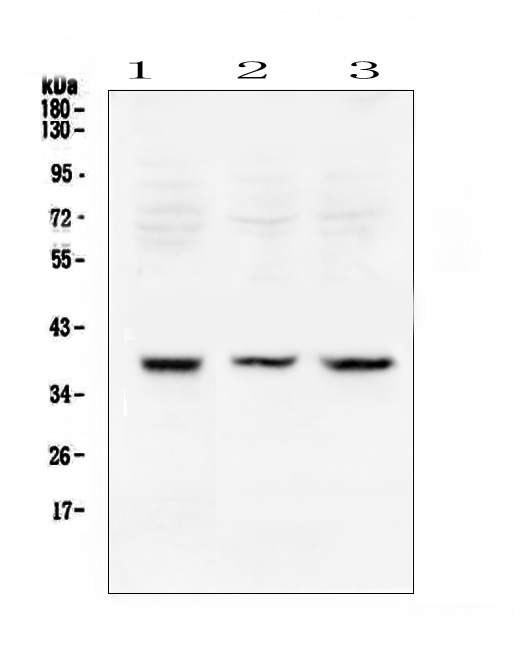 Western blot analysis of Rad51 using anti-Rad51 antibody (A00088). Electrophoresis was performed on a 5-20% SDS-PAGE gel at 70V (Stacking gel) / 90V (Resolving gel) for 2-3 hours. The sample well of each lane was loaded with 50ug of sample under reducing conditions. Lane 1: rat testis tissue lysates, Lane 2: mouse testis tissue lysates, Lane 3: mouse thymus tissue lysates. After Electrophoresis, proteins were transferred to a Nitrocellulose membrane at 150mA for 50-90 minutes. Blocked the membrane with 5% Non-fat Milk/ TBS for 1.5 hour at RT. The membrane was incubated with rabbit anti-Rad51 antigen affinity purified polyclonal antibody (Catalog # A00088) at 0.5 μg/mL overnight at 4°C, then washed with TBS-0.1%Tween 3 times with 5 minutes each and probed with a goat anti-rabbit IgG-HRP secondary antibody at a dilution of 1:10000 for 1.5 hour at RT. The signal is developed using an Enhanced Chemiluminescent detection (ECL) kit (Catalog # EK1002) with Tanon 5200 system. A specific band was detected for Rad51 at approximately 39KD. The expected band size for Rad51 is at 36KD.