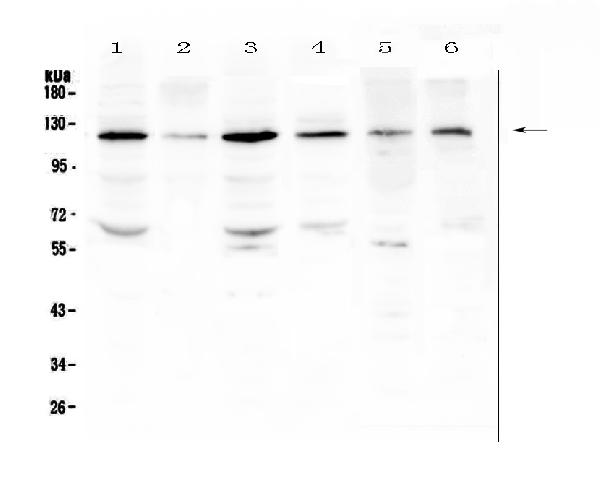 Western blot analysis of PDGFRB using anti-PDGFRB antibody (A00096-1). Electrophoresis was performed on a 5-20% SDS-PAGE gel at 70V (Stacking gel) / 90V (Resolving gel) for 2-3 hours. The sample well of each lane was loaded with 50ug of sample under reducing conditions. Lane 1: human Hela whole cell lysates, Lane 2: human HepG2 whole cell lysates, Lane 3: human SGC-7901 whole cell lysates, Lane 4: human K562 whole cell lysates, Lane 5: rat testis tissue lysates, Lane 6: mouse testis tissue lysates. After Electrophoresis, proteins were transferred to a Nitrocellulose membrane at 150mA for 50-90 minutes. Blocked the membrane with 5% Non-fat Milk/ TBS for 1.5 hour at RT. The membrane was incubated with rabbit anti-PDGFRB antigen affinity purified polyclonal antibody (Catalog # A00096-1) at 0.5 μg/mL overnight at 4℃, then washed with TBS-0.1%Tween 3 times with 5 minutes each and probed with a goat anti-rabbit IgG-HRP secondary antibody at a dilution of 1:10000 for 1.5 hour at RT. The signal is developed using an Enhanced Chemiluminescent detection (ECL) kit (Catalog # EK1002) with Tanon 5200 system. A specific band was detected for PDGFRB at approximately 120KD. The expected band size for PDGFRB is at 124KD.
