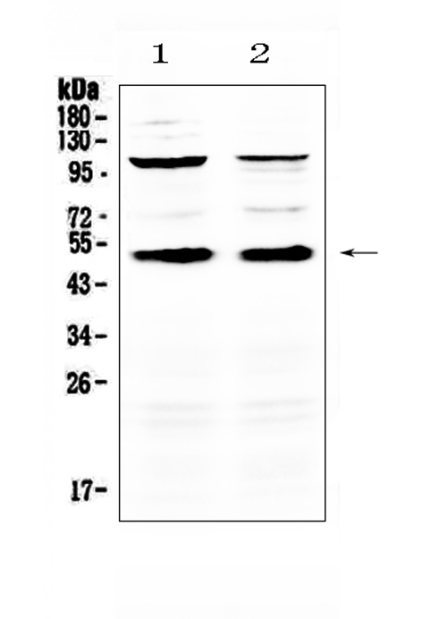 Western blot analysis of CD14 using anti-CD14 antibody (A00137). Electrophoresis was performed on a 5-20% SDS-PAGE gel at 70V (Stacking gel) / 90V (Resolving gel) for 2-3 hours. The sample well of each lane was loaded with 50ug of sample under reducing conditions. Lane 1: mouse thymus tissue lysates, Lane 2: mouse spleen tissue lysates. After Electrophoresis, proteins were transferred to a Nitrocellulose membrane at 150mA for 50-90 minutes. Blocked the membrane with 5% Non-fat Milk/ TBS for 1.5 hour at RT. The membrane was incubated with rabbit anti-CD14 antigen affinity purified polyclonal antibody (Catalog # A00137) at 0.5 ug/mL overnight at 4 then washed with TBS-0.1%Tween 3 times with 5 minutes each and probed with a goat anti-rabbit IgG-HRP secondary antibody at a dilution of 1:10000 for 1.5 hour at RT. The signal is developed using an Enhanced Chemiluminescent detection (ECL) kit (Catalog # EK1002) with Tanon 5200 system. A specific band was detected for CD14 at approximately 50KD. The expected band size for CD14 is at 40KD.