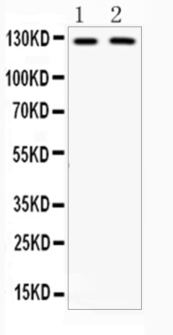 Western blot analysis of CD11b using anti-CD11b antibody (A00144).