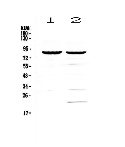 Western blot analysis of CD19 using anti-CD19 antibody (A00154-1).