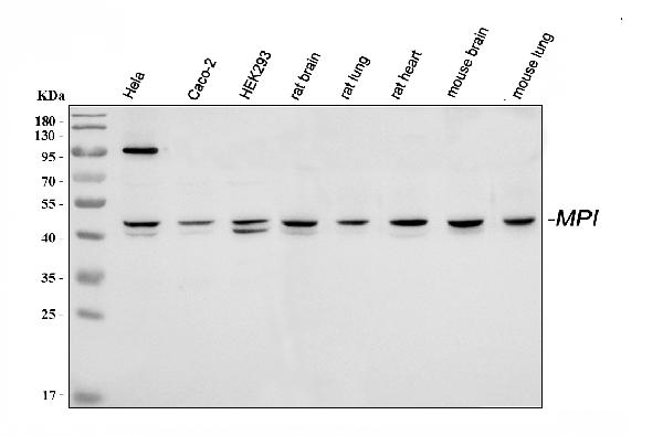 Western blot analysis of MPI using anti-MPI antibody (A00175).