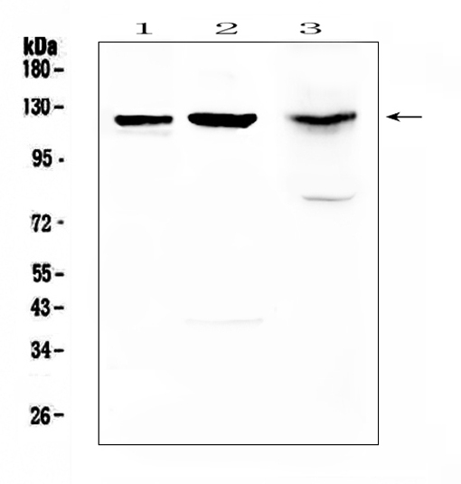 Western blot analysis of MUC1 using anti-MUC1 antibody (A00187). Electrophoresis was performed on a 5-20% SDS-PAGE gel at 70V (Stacking gel) / 90V (Resolving gel) for 2-3 hours. The sample well of each lane was loaded with 50ug of sample under reducing conditions. Lane 1: rat lung tissue lysates, Lane 2: rat pancreas tissue lysates, Lane 3: mouse pancreas tissue lysates. After Electrophoresis, proteins were transferred to a Nitrocellulose membrane at 150mA for 50-90 minutes. Blocked the membrane with 5% Non-fat Milk/ TBS for 1.5 hour at RT. The membrane was incubated with rabbit anti-MUC1 antigen affinity purified polyclonal antibody (Catalog # A00187) at 0.5 μg/mL overnight at 4°C, then washed with TBS-0.1%Tween 3 times with 5 minutes each and probed with a goat anti-rabbit IgG-HRP secondary antibody at a dilution of 1:10000 for 1.5 hour at RT. The signal is developed using an Enhanced Chemiluminescent detection (ECL) kit (Catalog # EK1002) with Tanon 5200 system. A specific band was detected for MUC1 at approximately 122KD. The expected band size for MUC1 is at 122KD.