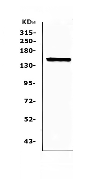 Western blot analysis of Flt3 / CD135 using anti-Flt3 / CD135 antibody (A00188-4). Electrophoresis was performed on a 5-20% SDS-PAGE gel at 70V (Stacking gel) / 90V (Resolving gel) for 2-3 hours. The sample well of each lane was loaded with 50ug of sample under reducing conditions. Lane 1: mouse brain tissue lysates. After Electrophoresis, proteins were transferred to a Nitrocellulose membrane at 150mA for 50-90 minutes. Blocked the membrane with 5% Non-fat Milk/ TBS for 1.5 hour at RT. The membrane was incubated with rabbit anti-Flt3 / CD135 antigen affinity purified polyclonal antibody (Catalog # A00188-4) at 0.5 ug/mL overnight at 4 then washed with TBS-0.1%Tween 3 times with 5 minutes each and probed with a goat anti-rabbit IgG-HRP secondary antibody at a dilution of 1:10000 for 1.5 hour at RT. The signal is developed using an Enhanced Chemiluminescent detection (ECL) kit (Catalog # EK1002) with Tanon 5200 system. A specific band was detected for Flt3 / CD135 at approximately 160KD. The expected band size for Flt3 / CD135 is at 113KD.