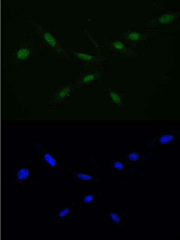 IF analysis of Ran using anti-Ran antibody (A00204-1) Ran was detected in immunocytochemical section of U20S cell. Enzyme antigen retrieval was performed using IHC enzyme antigen retrieval reagent (AR0022) for 15 mins. The cells were blocked with 10% goat serum. And then incubated with 2μg/mL rabbit anti-Ran Antibody (A00204-1) overnight at 4°C. DyLight®488 Conjugated Goat Anti-Rabbit IgG (BA1127) was used as secondary antibody at 1:100 dilution and incubated for 30 minutes at 37°C. The section was counterstained with DAPI. Visualize using a fluorescence microscope and filter sets appropriate for the label used.