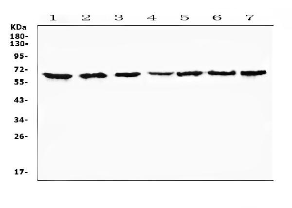 Western blot analysis of CD86 using anti-CD86 antibody (A00220-1). Electrophoresis was performed on a 5-20% SDS-PAGE gel at 70V (Stacking gel) / 90V (Resolving gel) for 2-3 hours. The sample well of each lane was loaded with 50ug of sample under reducing conditions. Lane 1: rat spleen tissue lysate, Lane 2: rat liver tissue lysate, Lane 3: rat PC-12 cell lysate, Lane 4: mouse spleen tissue lysate, Lane 5: mouse thymus tissue lysate, Lane 6: mouse brain tissue lysate, Lane 7: human COLO-320 cell lysate. After Electrophoresis, proteins were transferred to a Nitrocellulose membrane at 150mA for 50-90 minutes. Blocked the membrane with 5% Non-fat Milk/ TBS for 1.5 hour at RT. The membrane was incubated with rabbit anti-CD86 antigen affinity purified polyclonal antibody (Catalog # A00220-1) at 0.5 μg/mL overnight at 4°C, then washed with TBS-0.1%Tween 3 times with 5 minutes each and probed with a goat anti-rabbit IgG-HRP secondary antibody at a dilution of 1:10000 for 1.5 hour at RT. The signal is developed using an Enhanced Chemiluminescent detection (ECL) kit (Catalog # EK1002) with Tanon 5200 system. A specific band was detected for CD86 at approximately 60-80KD. The expected band size for CD86 is at 36KD.