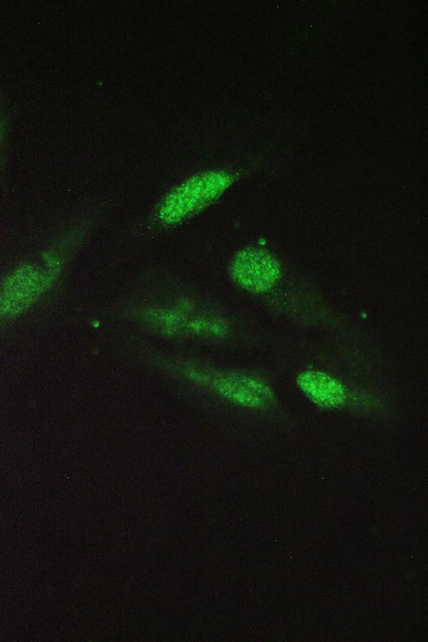 IF analysis of SRI using anti-SRI antibody (A00222) SRI was detected in immunocytochemical section of U20S cell. Enzyme antigen retrieval was performed using IHC enzyme antigen retrieval reagent (AR0022) for 15 mins. The cells were blocked with 10% goat serum. And then incubated with 2μg/mL rabbit anti-SRI Antibody (A00222) overnight at 4°C. DyLight®488 Conjugated Goat Anti-Rabbit IgG (BA1127) was used as secondary antibody at 1:100 dilution and incubated for 30 minutes at 37°C. The section was counterstained with DAPI. Visualize using a fluorescence microscope and filter sets appropriate for the label used.