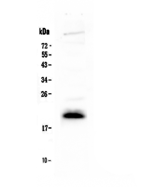 Western blot analysis of IL4 using anti-IL4 antibody (A00230).