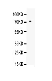 Western blot analysis of MMP2 using anti-MMP2 antibody (A00286). Electrophoresis was performed on a 5-20% SDS-PAGE gel at 70V (Stacking gel) / 90V (Resolving gel) for 2-3 hours. lane 1: recombinant human MMP2 protein 1ng After Electrophoresis, proteins were transferred to a Nitrocellulose membrane at 150mA for 50-90 minutes. Blocked the membrane with 5% Non-fat Milk/ TBS for 1.5 hour at RT. The membrane was incubated with rabbit anti-MMP2 antigen affinity purified polyclonal antibody (Catalog # A00286) at 0.5 μg/mL overnight at 4°C, then washed with TBS-0.1%Tween 3 times with 5 minutes each and probed with a goat anti-rabbit IgG-HRP secondary antibody at a dilution of 1:10000 for 1.5 hour at RT. The signal is developed using an Enhanced Chemiluminescent detection (ECL) kit (Catalog # EK1002) with Tanon 5200 system. A specific band was detected for MMP2 at approximately 71KD. The expected band size for MMP2 is at 71KD.