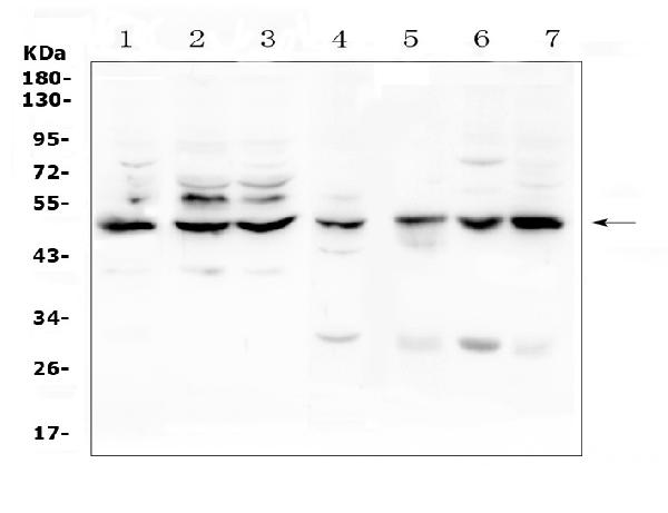 Western blot analysis of TNF Receptor I using anti-TNF Receptor I antibody (A00294-3). Electrophoresis was performed on a 5-20% SDS-PAGE gel at 70V (Stacking gel) / 90V (Resolving gel) for 2-3 hours. The sample well of each lane was loaded with 50ug of sample under reducing conditions. Lane 1: human Hela whole cell lysate, Lane 2: human K562 whole cell lysate, Lane 3: human Caco-2 whole cell lysate, Lane 4: rat liver tissue lysates, Lane 5: mouse small intestine tissue lysates, Lane 6: mouse liver tissue lysates, Lane 7: mouse HEPA1-6 whole cell lysate. After Electrophoresis, proteins were transferred to a Nitrocellulose membrane at 150mA for 50-90 minutes. Blocked the membrane with 5% Non-fat Milk/ TBS for 1.5 hour at RT. The membrane was incubated with rabbit anti-TNF Receptor I antigen affinity purified polyclonal antibody (Catalog # A00294-3) at 0.5 μg/mL overnight at 4°C, then washed with TBS-0.1%Tween 3 times with 5 minutes each and probed with a goat anti-rabbit IgG-HRP secondary antibody at a dilution of 1:10000 for 1.5 hour at RT. The signal is developed using an Enhanced Chemiluminescent detection (ECL) kit (Catalog # EK1002) with Tanon 5200 system. A specific band was detected for TNF Receptor I at approximately 50KD. The expected band size for TNF Receptor I is at 50KD.