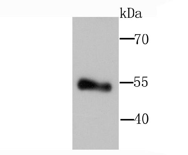 Lipoprotein Lipase LPL Antibody A00316