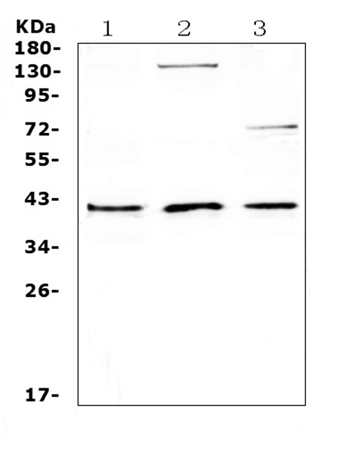 Western blot analysis of CD47 using anti-CD47 antibody (A00360-1). Electrophoresis was performed on a 5-20% SDS-PAGE gel at 70V (Stacking gel) / 90V (Resolving gel) for 2-3 hours. The sample well of each lane was loaded with 50ug of sample under reducing conditions. Lane 1: human MCF-7 whole cell lysates, Lane 2: human SK-OV-3 whole cell lysates, Lane 3: human PANC-1 whole cell lysates. After Electrophoresis, proteins were transferred to a Nitrocellulose membrane at 150mA for 50-90 minutes. Blocked the membrane with 5% Non-fat Milk/ TBS for 1.5 hour at RT. The membrane was incubated with rabbit anti-CD47 antigen affinity purified polyclonal antibody (Catalog # A00360-1) at 0.5 ug/mL overnight at 4 then washed with TBS-0.1%Tween 3 times with 5 minutes each and probed with a goat anti-rabbit IgG-HRP secondary antibody at a dilution of 1:10000 for 1.5 hour at RT. The signal is developed using an Enhanced Chemiluminescent detection (ECL) kit (Catalog # EK1002) with Tanon 5200 system. A specific band was detected for CD47 at approximately 41KD. The expected band size for CD47 is at 35KD.