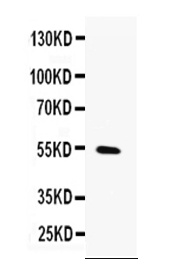 Western blot analysis of MMP13 using anti-MMP13 antibody (A00420). Electrophoresis was performed on a 5-20% SDS-PAGE gel at 70V (Stacking gel) / 90V (Resolving gel) for 2-3 hours. The sample well of each lane was loaded with 50ug of sample under reducing conditions. Lane 1: HELA whole cell lysates. After Electrophoresis, proteins were transferred to a Nitrocellulose membrane at 150mA for 50-90 minutes. Blocked the membrane with 5% Non-fat Milk/ TBS for 1.5 hour at RT. The membrane was incubated with rabbit anti-MMP13 antigen affinity purified polyclonal antibody (Catalog # A00420) at 0.5 μg/mL overnight at 4°C, then washed with TBS-0.1%Tween 3 times with 5 minutes each and probed with a goat anti-rabbit IgG-HRP secondary antibody at a dilution of 1:10000 for 1.5 hour at RT. The signal is developed using an Enhanced Chemiluminescent detection (ECL) kit (Catalog # EK1002) with Tanon 5200 system. A specific band was detected for MMP13 at approximately 54KD. The expected band size for MMP13 is at 54KD.