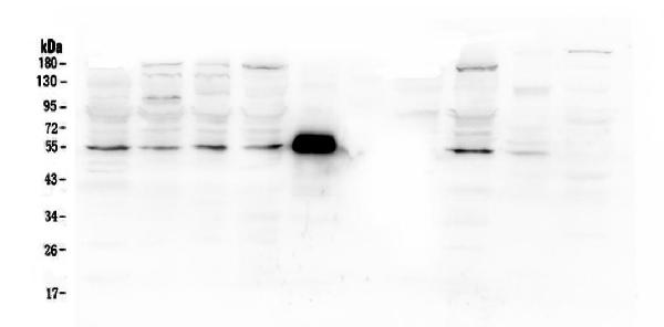 Western blot analysis of MMP13 using anti-MMP13 antibody (A00420). Electrophoresis was performed on a 5-20% SDS-PAGE gel at 70V (Stacking gel) / 90V (Resolving gel) for 2-3 hours. The sample well of each lane was loaded with 50ug of sample under reducing conditions. Lane 1: human PC-3 whole cell lysates, Lane 2: human U20S whole cell lysates, Lane 3: human A549 whole cell lysates, Lane 4: human HEK293 whole cell lysates. Lane 5: Rabbit IgG(55KD), Lane 6: Marker 1113 Lane 7: human MDA-MB-453 whole cell lysates, Lane 8: monkey COS-7 whole cell lysates, Lane 9: rat lung tissue lysates, Lane 10: mouse lung tissue lysates, After Electrophoresis, proteins were transferred to a Nitrocellulose membrane at 150mA for 50-90 minutes. Blocked the membrane with 5% Non-fat Milk/ TBS for 1.5 hour at RT. The membrane was incubated with rabbit anti-MMP13 antigen affinity purified polyclonal antibody (Catalog # A00420) at 0.5 μg/mL overnight at 4°C, then washed with TBS-0.1%Tween 3 times with 5 minutes each and probed with a goat anti-rabbit IgG-HRP secondary antibody at a dilution of 1:10000 for 1.5 hour at RT. The signal is developed using an Enhanced Chemiluminescent detection (ECL) kit (Catalog # EK1002) with Tanon 5200 system. A specific band was detected for MMP13 at approximately 54KD. The expected band size for MMP13 is at 54KD.