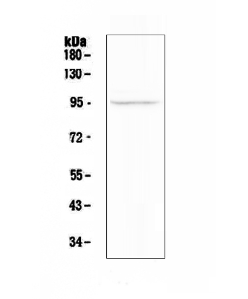 Western blot analysis of FAP using anti-FAP antibody (A00422-1). Electrophoresis was performed on a 5-20% SDS-PAGE gel at 70V (Stacking gel) / 90V (Resolving gel) for 2-3 hours. The sample well of each lane was loaded with 50ug of sample under reducing conditions. Lane 1: human A375 cell lysates. After Electrophoresis, proteins were transferred to a Nitrocellulose membrane at 150mA for 50-90 minutes. Blocked the membrane with 5% Non-fat Milk/ TBS for 1.5 hour at RT. The membrane was incubated with rabbit anti-FAP antigen affinity purified polyclonal antibody (Catalog # A00422-1) at 0.5 μg/mL overnight at 4°C, then washed with TBS-0.1%Tween 3 times with 5 minutes each and probed with a goat anti-rabbit IgG-HRP secondary antibody at a dilution of 1:10000 for 1.5 hour at RT. The signal is developed using an Enhanced Chemiluminescent detection (ECL) kit (Catalog # EK1002) with Tanon 5200 system. A specific band was detected for FAP at approximately 95KD. The expected band size for FAP is at 88KD.