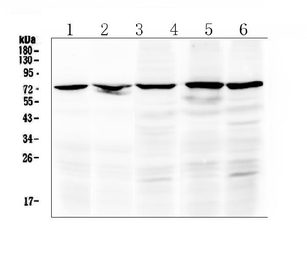 Western blot analysis of Raf1 using anti-Raf1 antibody (A00446-1). Electrophoresis was performed on a 5-20% SDS-PAGE gel at 70V (Stacking gel) / 90V (Resolving gel) for 2-3 hours. The sample well of each lane was loaded with 50ug of sample under reducing conditions. Lane 1: rat kidney tissue lysate, Lane 2: mouse kidney tissue lysate, Lane 3: human MCF-7 whole cell lysate, Lane 4: human 22RV1 whole cell lysate, Lane 5: human Hela whole cell lysate. After Electrophoresis, proteins were transferred to a Nitrocellulose membrane at 150mA for 50-90 minutes. Blocked the membrane with 5% Non-fat Milk/ TBS for 1.5 hour at RT. The membrane was incubated with rabbit anti-Raf1 antigen affinity purified polyclonal antibody (Catalog # A00446-1) at 0.5 μg/mL overnight at 4°C, then washed with TBS-0.1%Tween 3 times with 5 minutes each and probed with a goat anti-rabbit IgG-HRP secondary antibody at a dilution of 1:10000 for 1.5 hour at RT. The signal is developed using an Enhanced Chemiluminescent detection (ECL) kit (Catalog # EK1002) with Tanon 5200 system. A specific band was detected for Raf1 at approximately 73KD. The expected band size for Raf1 is at 73KD.