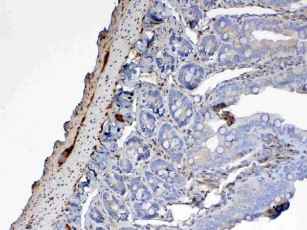 IHC analysis of Galectin 1 using anti-Galectin 1 antibody (A00470).